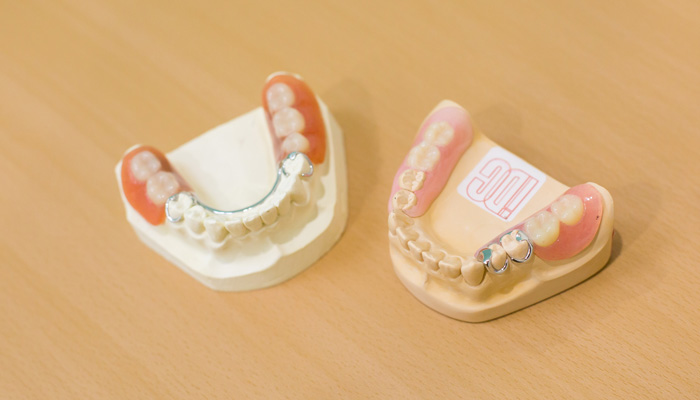 スギヤマ歯科医院で使用している部分入れ歯が二つ並んで映っている写真