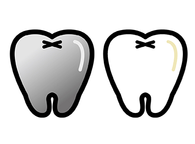 白い歯 | スギヤマ歯科医院