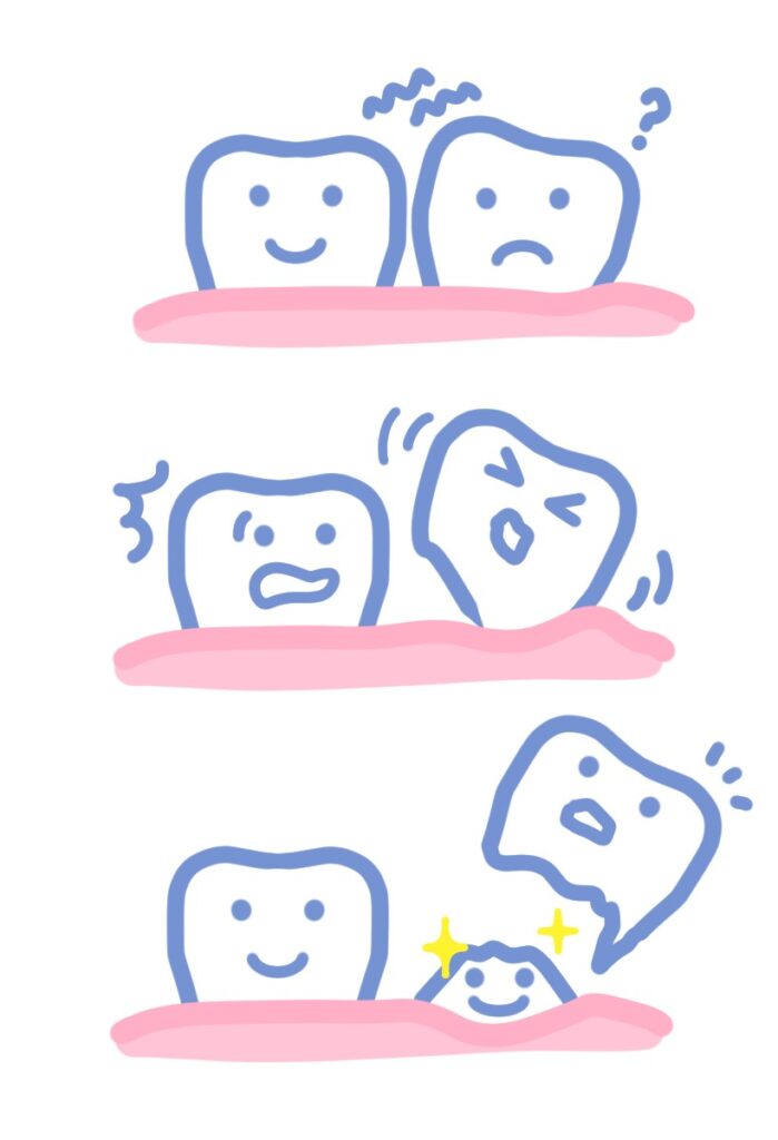 大和市鶴間の歯医者スギヤマ歯科医院　小児義歯とは？歯の生え変わりの仕組みと本数について