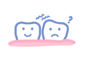大和市鶴間スギヤマ歯科医院 部分入れ歯は若い年齢の方にもおすすめの治療法03