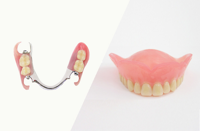 大和市鶴間の歯医者スギヤマ歯科医院　「歯が抜けたときの治療方法」1